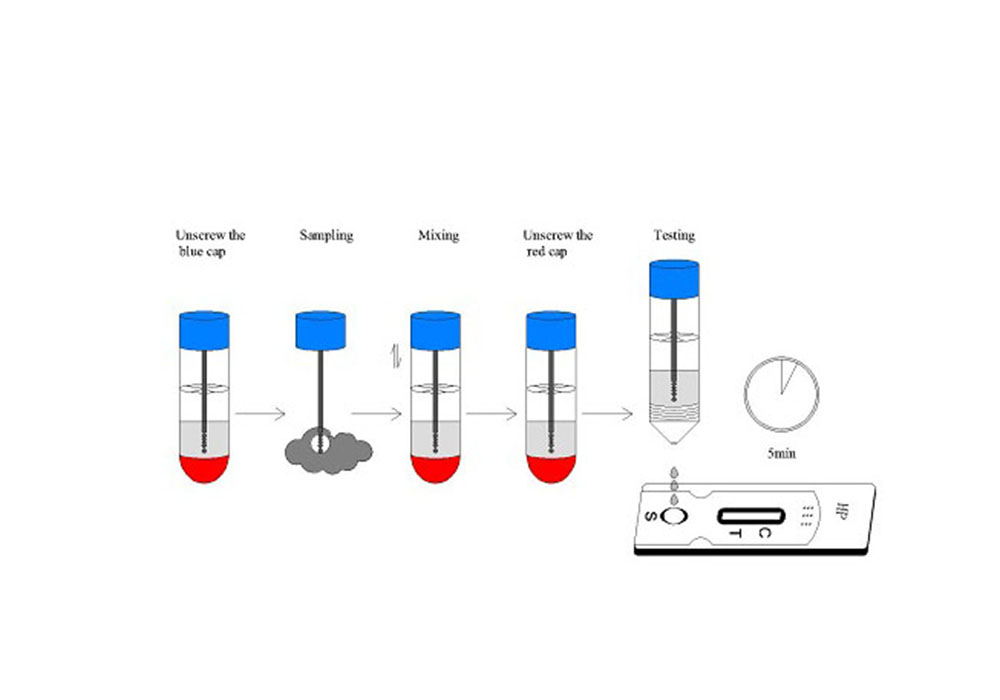 Shanghai Iven Medical Technology Co.,Ltd.’s superior Diagnostic Kit for